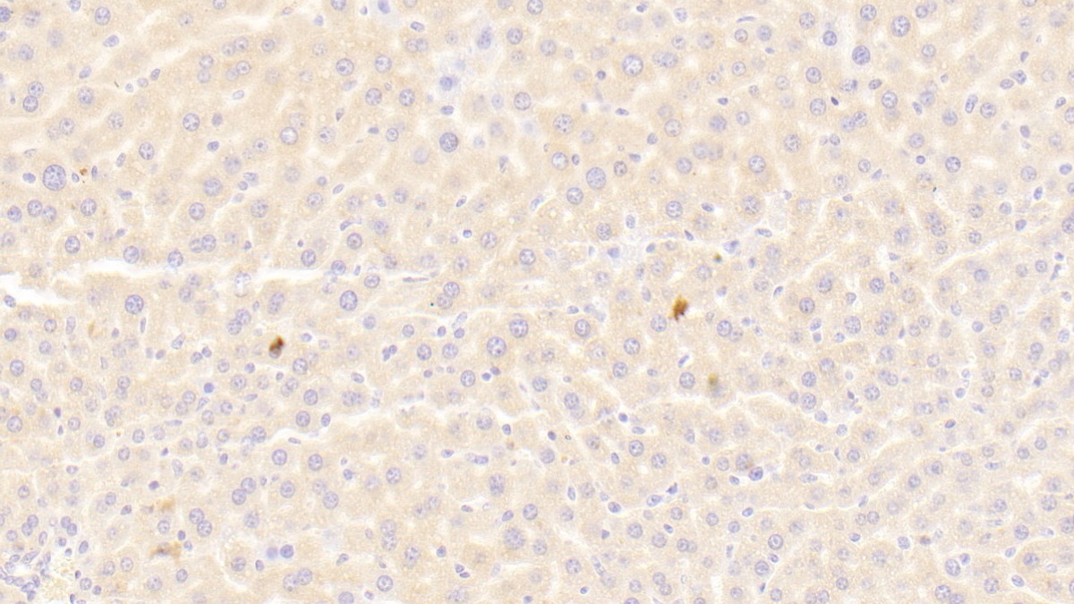 Polyclonal Antibody to TNFRSF1A Associated Via Death Domain Protein (TRADD)