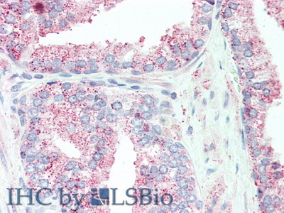 Polyclonal Antibody to Tumor Necrosis Factor Alpha Induced Protein 6 (TNFaIP6)