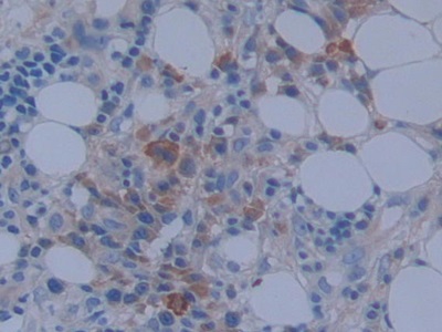 Polyclonal Antibody to Metastasis Associated In Colon Cancer 1 (MACC1)