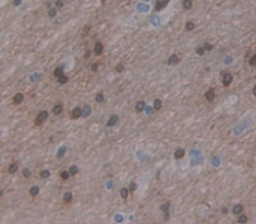 Polyclonal Antibody to Zinc Finger Homeobox Protein 4 (ZFHX4)