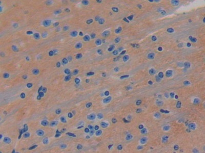 Polyclonal Antibody to Leucine Rich Repeats And Immunoglobulin Like Domains Protein 3 (LRIG3)