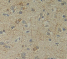 Polyclonal Antibody to Uracil Phosphoribosyltransferase (UPRT)