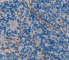 Polyclonal Antibody to T-Cell Immunoreceptor With Ig And ITIM Domains Protein (TIGIT)