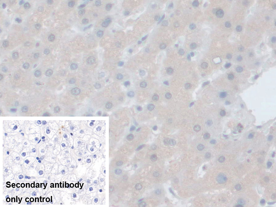 Polyclonal Antibody to Hepatocellular Carcinoma Related Protein 1 (HCRP1)