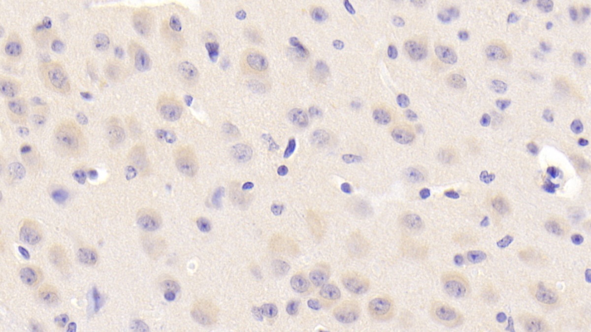 Polyclonal Antibody to Nei Endonuclease VIII Like Protein 3 (NEIL3)