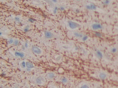 Polyclonal Antibody to Cell Death Inducing DFFA Like Effector C (CIDEC)