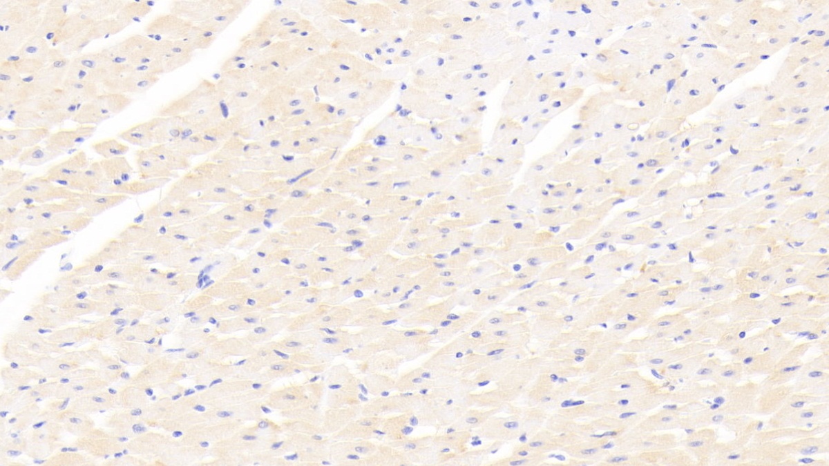 Polyclonal Antibody to Cell Death Inducing DFFA Like Effector C (CIDEC)