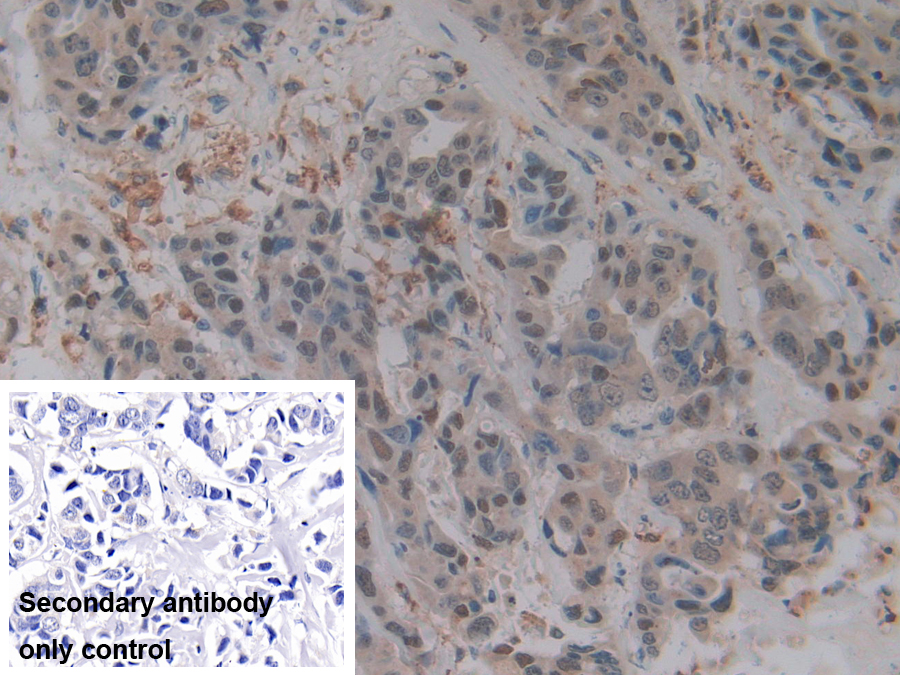 Polyclonal Antibody to Sp140 Nuclear Body Protein (SP140)