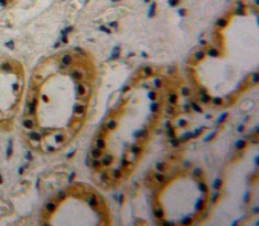 Polyclonal Antibody to Thrombospondin Type I Domain Containing Protein 7A (THSD7A)