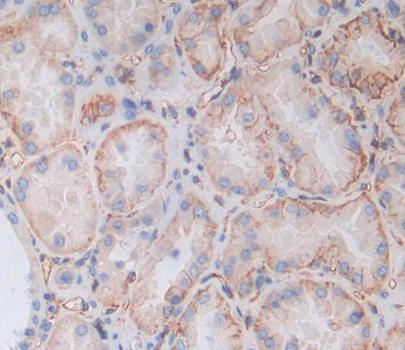 Polyclonal Antibody to Heat Shock 70kDa Protein 12B (HSPA12B)