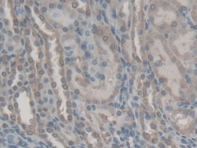 Polyclonal Antibody to Retinol Binding Protein 5, Cellular (RBP5)