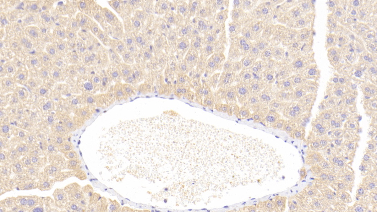 Polyclonal Antibody to T-Cell Activation Rho GTPase Activating Protein (TAGAP)