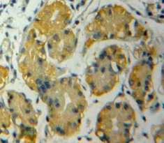 Polyclonal Antibody to A Disintegrin And Metalloproteinase With Thrombospondin 12 (ADAMTS12)