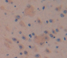 Polyclonal Antibody to A Disintegrin And Metalloproteinase With Thrombospondin 12 (ADAMTS12)