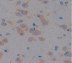 Polyclonal Antibody to A Disintegrin And Metalloproteinase With Thrombospondin 12 (ADAMTS12)