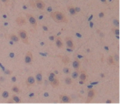 Polyclonal Antibody to Wingless Type MMTV Integration Site Family, Member 10A (WNT10A)