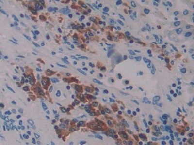 Polyclonal Antibody to Linker For Activation Of T-Cells Family, Member 2 (LAT2)