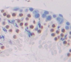 Polyclonal Antibody to T-Box Protein 21 (TBX21)