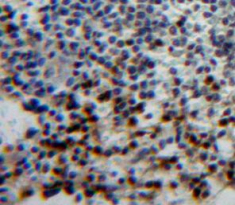 Polyclonal Antibody to T-Box Protein 21 (TBX21)