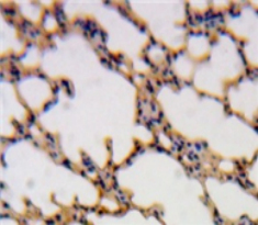 Polyclonal Antibody to SH2 Domain Containing Protein 1A (SH2D1A)