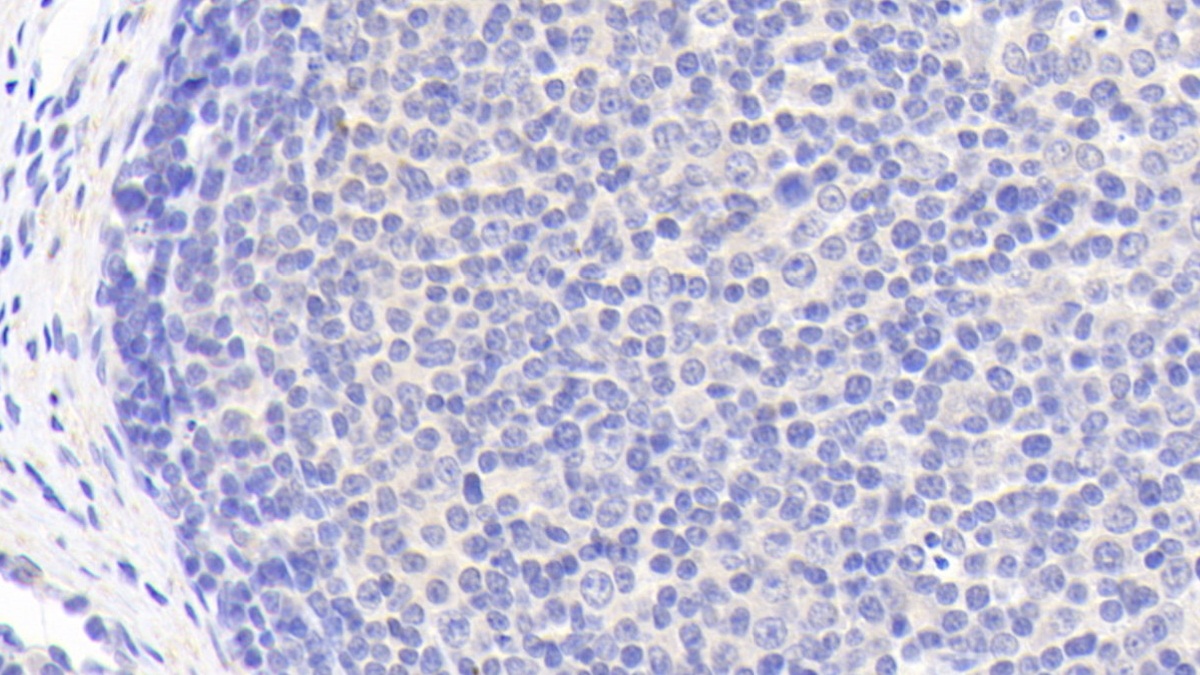 Polyclonal Antibody to Proteasome 26S Subunit, Non ATPase 8 (PSMD8)