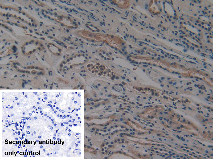 Polyclonal Antibody to Proteasome 26S Subunit, Non ATPase 9 (PSMD9)