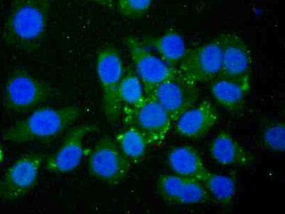 Polyclonal Antibody to Proteasome 26S Subunit, Non ATPase 13 (PSMD13)