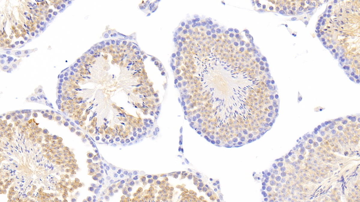 Polyclonal Antibody to Pim-2 Oncogene (PIM2)