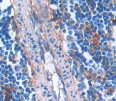 Polyclonal Antibody to Pim-2 Oncogene (PIM2)