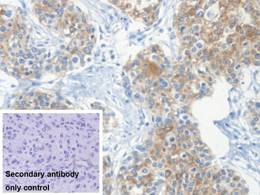 Polyclonal Antibody to Keratin 33A (KRT33A)