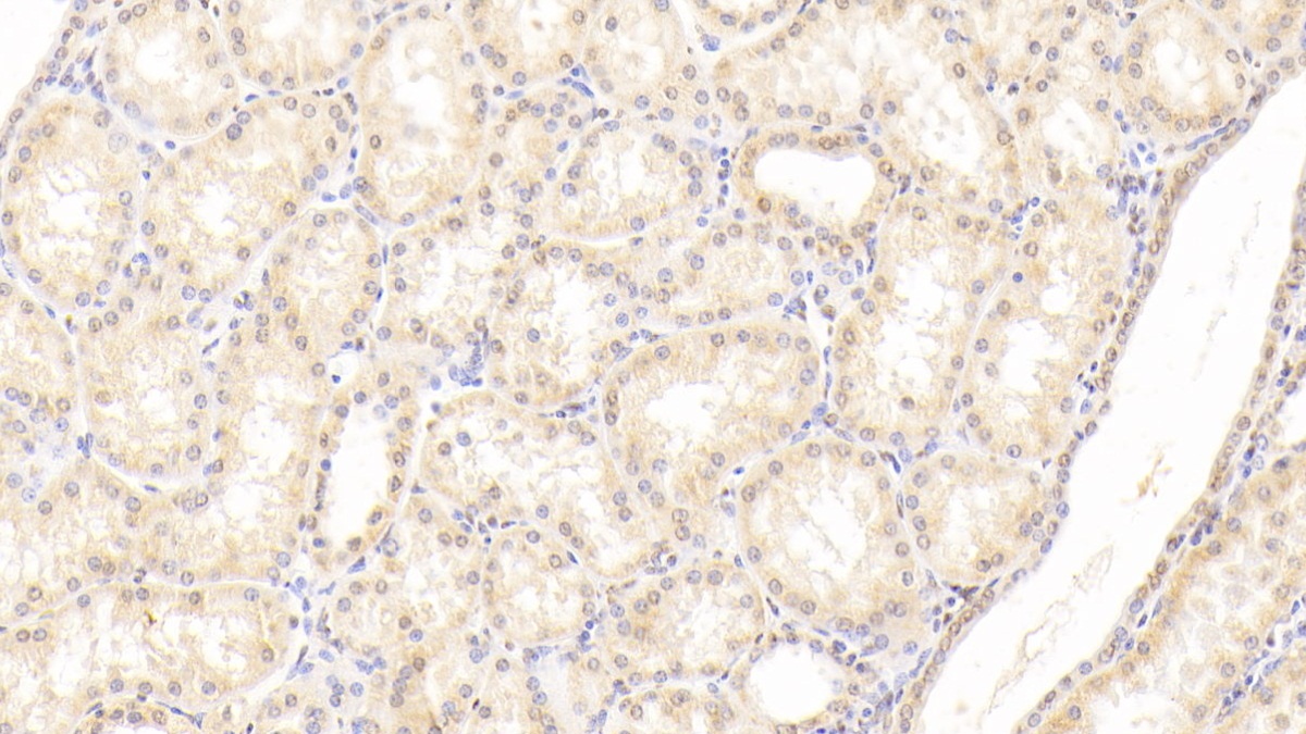 Polyclonal Antibody to Histone Cluster 2, H2be (HIST2H2BE)