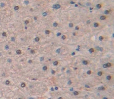 Polyclonal Antibody to Histone Cluster 1, H2aj (HIST1H2AJ)