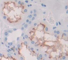 Polyclonal Antibody to Cell Adhesion Molecule With Homology To L1CAM (CHL1)