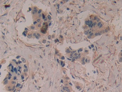 Polyclonal Antibody to Cluster Of Differentiation 8b (CD8b)