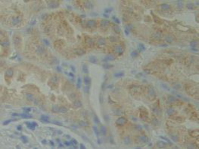 Polyclonal Antibody to BMX Non Receptor Tyrosine Kinase (BMX)