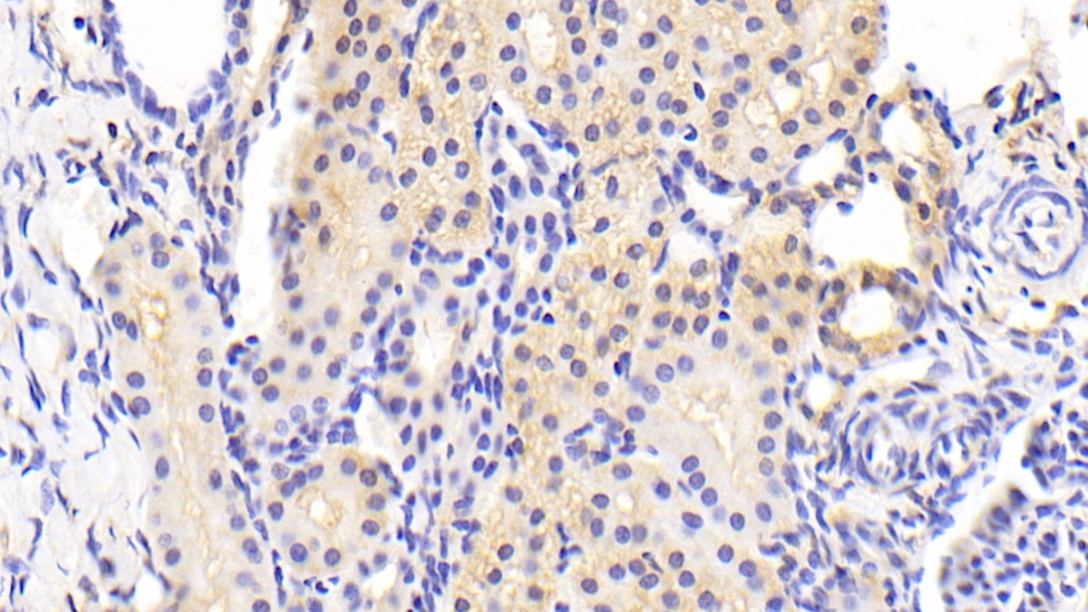 Polyclonal Antibody to Bcl2 Like Protein 11 (BCL2L11)