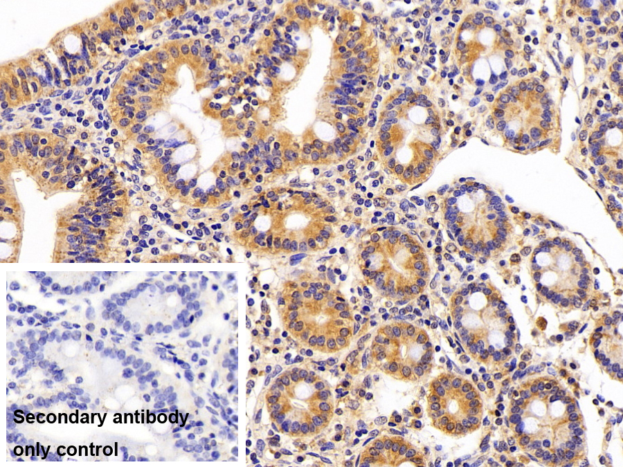 Polyclonal Antibody to Semaphorin 4B (SEMA4B)