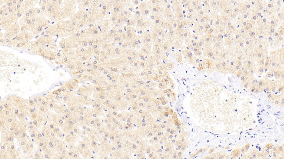 Polyclonal Antibody to Semaphorin 4B (SEMA4B)