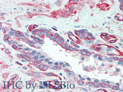 Polyclonal Antibody to Myosin Light Chain 12A (MYL12A)