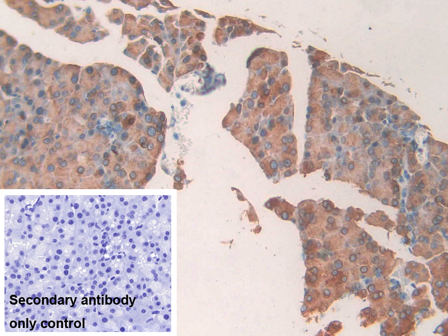 Polyclonal Antibody to CUB And Zona Pellucida Like Domains Protein 1 (CUZD1)