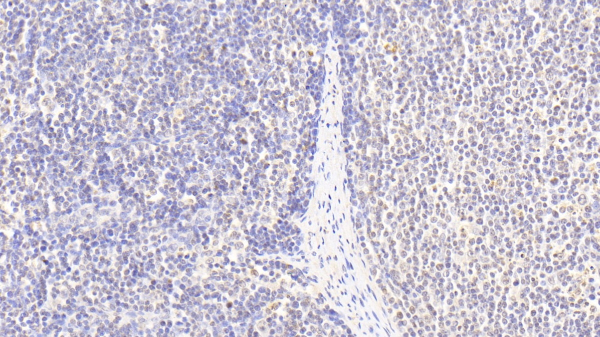 Polyclonal Antibody to Histone Cluster 2, H3a (HIST2H3A)