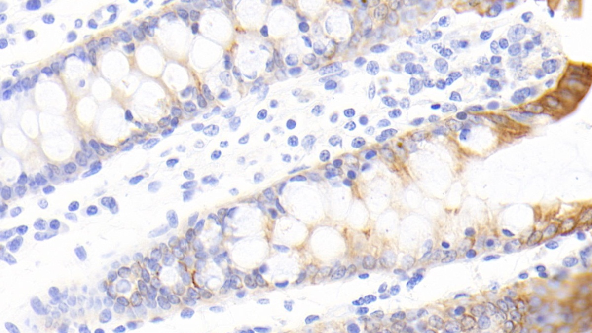 Polyclonal Antibody to Family With Sequence Similarity 5, Member C (FAM5C)