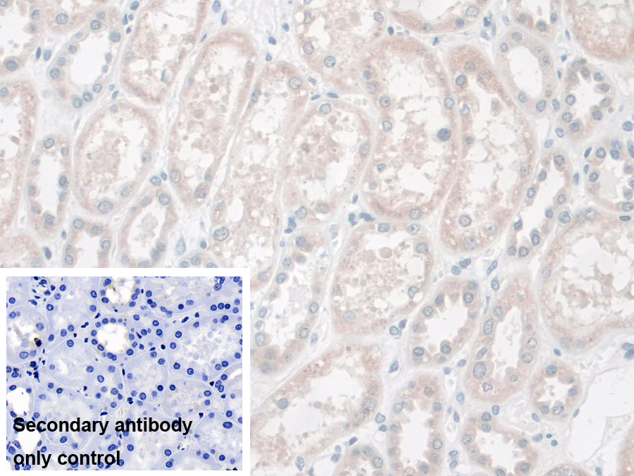 Polyclonal Antibody to LETM1 Domain Containing Protein 1 (LETMD1)