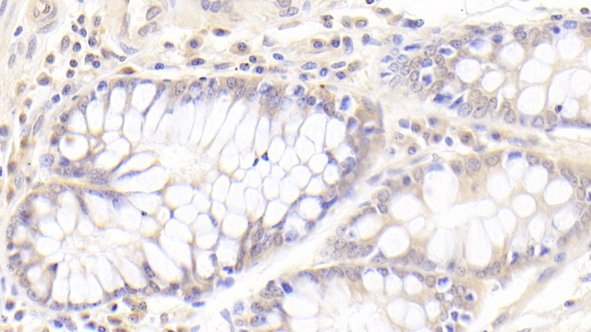 Polyclonal Antibody to Coenzyme Q10 Homolog B (COQ10B)