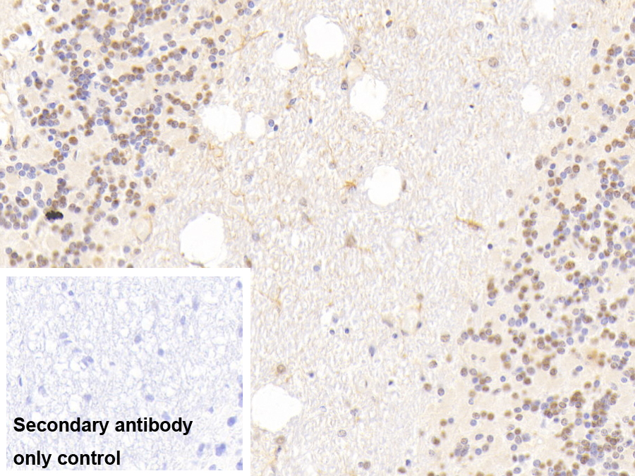 Polyclonal Antibody to Ly1 Antibody Reactive Homolog (LYAR)