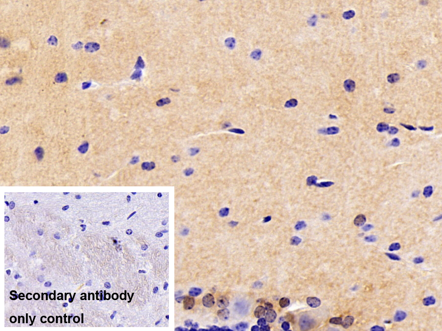 Polyclonal Antibody to Spindlin 3 (SPIN3)