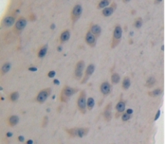 Polyclonal Antibody to LIM And Calponin Homology Domains Containing Protein 1 (LIMCH1)