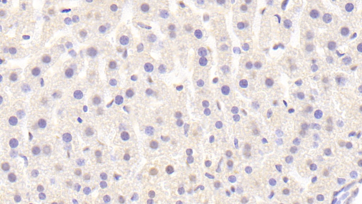 Polyclonal Antibody to Raft Linking Protein (Raftlin)