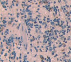 Polyclonal Antibody to Interferon Alpha 11 (IFNa11)