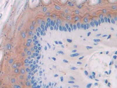 Polyclonal Antibody to Hyaluronoglucosaminidase 1 (HYAL1)